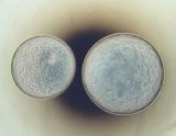 Twin embryos